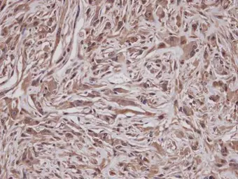 Anti-GRAP antibody [C2C3], C-term used in IHC (Paraffin sections) (IHC-P). GTX104623
