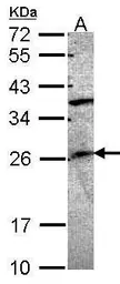 Anti-GRAP antibody [C2C3], C-term used in Western Blot (WB). GTX104623