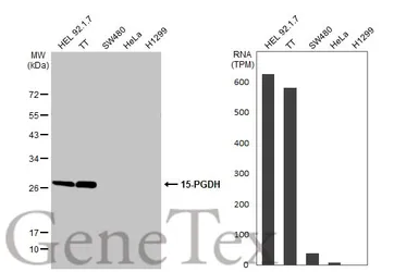 Anti-15-PGDH antibody [C2C3], C-term used in Western Blot (WB). GTX104625