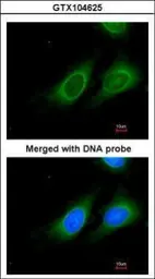 Anti-15-PGDH antibody [C2C3], C-term used in Immunocytochemistry/ Immunofluorescence (ICC/IF). GTX104625