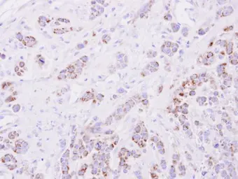 Anti-15-PGDH antibody [C2C3], C-term used in IHC (Paraffin sections) (IHC-P). GTX104625