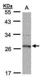 Anti-15-PGDH antibody [C2C3], C-term used in Western Blot (WB). GTX104625