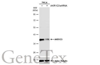 Anti-AKR1C3 antibody [C2C3], C-term used in Western Blot (WB). GTX104627