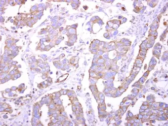 Anti-Bif-1 antibody [C2C3], C-term used in IHC (Paraffin sections) (IHC-P). GTX104636