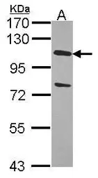 Anti-USP28 antibody [C3], C-term used in Western Blot (WB). GTX104646