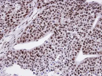 Anti-FCP1 antibody used in IHC (Paraffin sections) (IHC-P). GTX104649