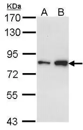 Anti-FCP1 antibody used in Western Blot (WB). GTX104649