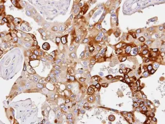Anti-PDE4D antibody [C3], C-term used in IHC (Paraffin sections) (IHC-P). GTX104652