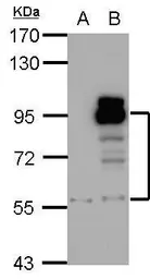 Anti-PDE4D antibody [C3], C-term used in Western Blot (WB). GTX104652