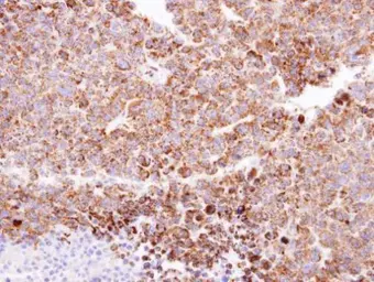 Anti-CLPP antibody [C2C3], C-term used in IHC (Paraffin sections) (IHC-P). GTX104656