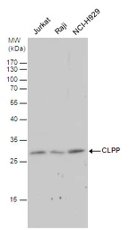 Anti-CLPP antibody [C2C3], C-term used in Western Blot (WB). GTX104656
