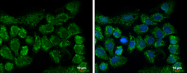 Anti-CLPP antibody [C2C3], C-term used in Immunocytochemistry/ Immunofluorescence (ICC/IF). GTX104656