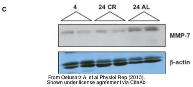 Anti-MMP7 antibody [C2C3], C-term used in Western Blot (WB). GTX104658