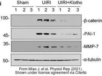 Anti-MMP7 antibody [C2C3], C-term used in Western Blot (WB). GTX104658