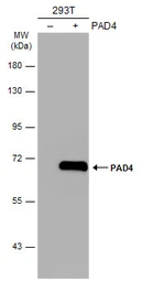 Anti-PAD4 antibody [N1], N-term used in Western Blot (WB). GTX104659