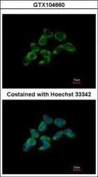Anti-DDAH1 antibody [C2C3], C-term used in Immunocytochemistry/ Immunofluorescence (ICC/IF). GTX104660