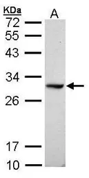 Anti-DDAH1 antibody [C2C3], C-term used in Western Blot (WB). GTX104660