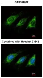 Anti-AICDA antibody [N1N2], N-term used in Immunocytochemistry/ Immunofluorescence (ICC/IF). GTX104662