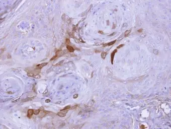 Anti-AICDA antibody [N1N2], N-term used in IHC (Paraffin sections) (IHC-P). GTX104662
