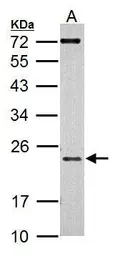 Anti-AICDA antibody [N1N2], N-term used in Western Blot (WB). GTX104662
