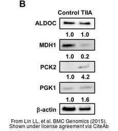 Anti-PCK2 antibody [C1C2], Internal used in Western Blot (WB). GTX104663