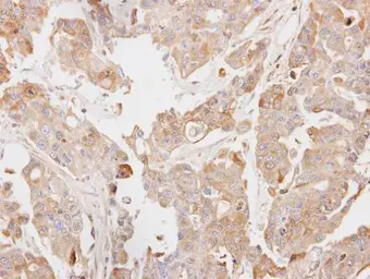 Anti-PCK2 antibody [C1C2], Internal used in IHC (Paraffin sections) (IHC-P). GTX104663