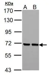 Anti-PCK2 antibody [C1C2], Internal used in Western Blot (WB). GTX104663