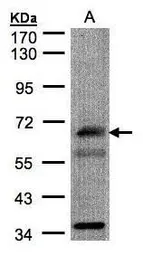 Anti-CHFR antibody [C3], C-term used in Western Blot (WB). GTX104667