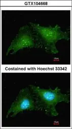Anti-RNF25 antibody [C2C3], C-term used in Immunocytochemistry/ Immunofluorescence (ICC/IF). GTX104668