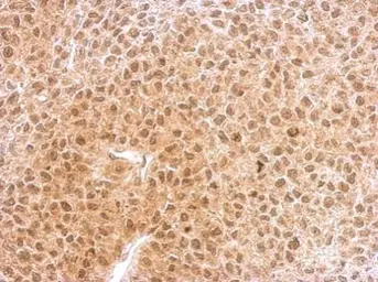 Anti-RNF25 antibody [C2C3], C-term used in IHC (Paraffin sections) (IHC-P). GTX104668