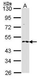 Anti-RNF25 antibody [C2C3], C-term used in Western Blot (WB). GTX104668