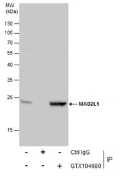 Anti-MAD2L1 antibody [C2C3], C-term used in Immunoprecipitation (IP). GTX104680
