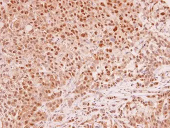 Anti-MAD2L1 antibody [C2C3], C-term used in IHC (Paraffin sections) (IHC-P). GTX104680