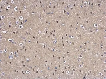 Anti-MAD2L1 antibody [C2C3], C-term used in IHC (Paraffin sections) (IHC-P). GTX104680