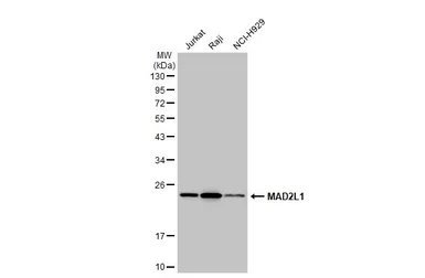 Anti-MAD2L1 antibody [C2C3], C-term used in Western Blot (WB). GTX104680