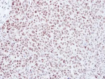 Anti-MAD2L1 antibody [C2C3], C-term used in IHC (Paraffin sections) (IHC-P). GTX104680