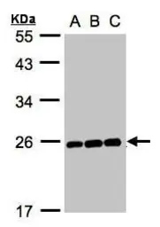 Anti-MAD2L1 antibody [C2C3], C-term used in Western Blot (WB). GTX104680