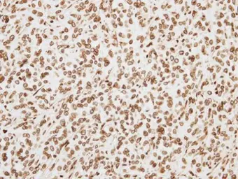 Anti-ORC6 antibody [C2C3], C-term used in IHC (Paraffin sections) (IHC-P). GTX104685