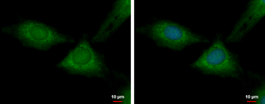 Anti-RPL37 antibody used in Immunocytochemistry/ Immunofluorescence (ICC/IF). GTX104688