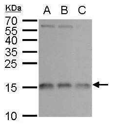 Anti-RPL37 antibody used in Western Blot (WB). GTX104688