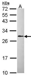 Anti-DCXR antibody [C2C3], C-term used in Western Blot (WB). GTX104696