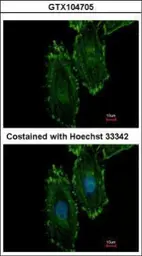 Anti-RASGRP4 antibody [N1N2], N-term used in Immunocytochemistry/ Immunofluorescence (ICC/IF). GTX104705