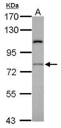 Anti-RASGRP4 antibody [N1N2], N-term used in Western Blot (WB). GTX104705