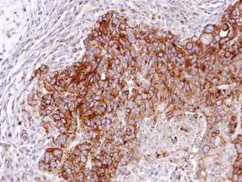 Anti-RASGRP4 antibody [N1N2], N-term used in IHC (Paraffin sections) (IHC-P). GTX104705