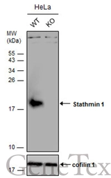 Anti-Stathmin 1 antibody used in Western Blot (WB). GTX104707