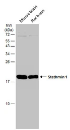 Anti-Stathmin 1 antibody used in Western Blot (WB). GTX104707