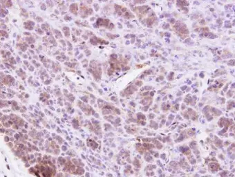Anti-MAP4K1 antibody [N1], N-term used in IHC (Paraffin sections) (IHC-P). GTX104708