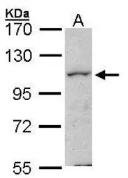 Anti-MAP4K1 antibody [N1], N-term used in Western Blot (WB). GTX104708