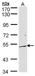 Anti-DUSP10 antibody [C3], C-term used in Western Blot (WB). GTX104712