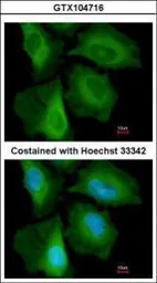 Anti-CacyBP antibody [C2C3], C-term used in Immunocytochemistry/ Immunofluorescence (ICC/IF). GTX104716